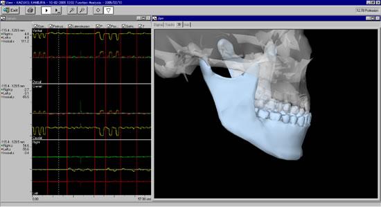 左は顎の色々な顎の動き(右、左、前、 開閉口）の位置関係、右は実際の顎の動きを骸骨を用いてわかりやすく示したものです。