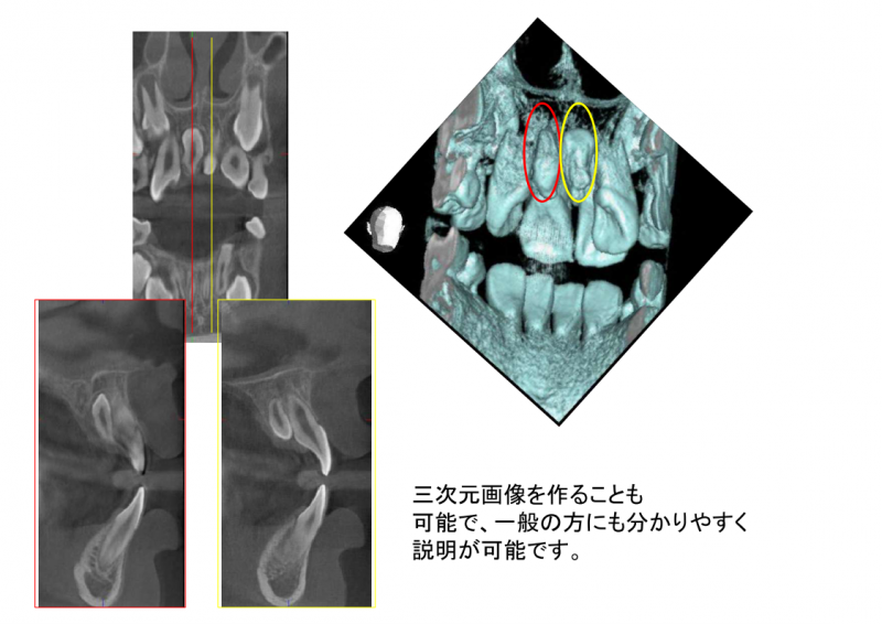 三次元画像を作ることも可能で、一般の方にも分かりやすく説明が可能です。