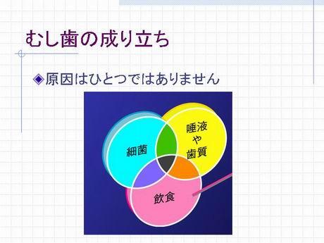 虫歯の原因は一つではありません。いろんな要素がかみ合った時に虫歯ができるのです。