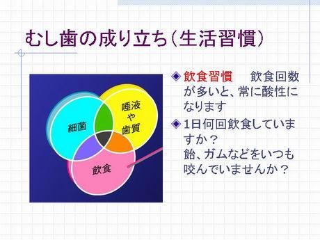 もう一つが、その方の生活習慣です。飲食回数が多かったり、糖分の摂取量が多いと、虫歯のできやすいお口の中になります。