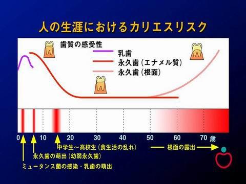 まず、人の生涯における虫歯のリスクのお話をします。永久歯への生え変わりの時期に虫歯になりやすいことは、一般に良く知られております。　しかし、見逃してはならないのは、高齢になってからも虫歯のリスクが高い時期があることです。