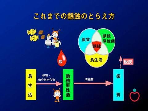 上の図は、以前まで考えられていた虫歯のできるプロセスです。砂糖を食べると、虫歯菌が酸を出し歯が解ける。－－こんな話を聞いたことはありませんか？