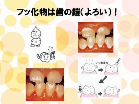 繰り返しますが、フッ素を上手に取り入れると、歯が強くなり虫歯になりにくい歯になるのです。皆さんも上手に生活に取り入れて虫歯と縁を切りましょう！　