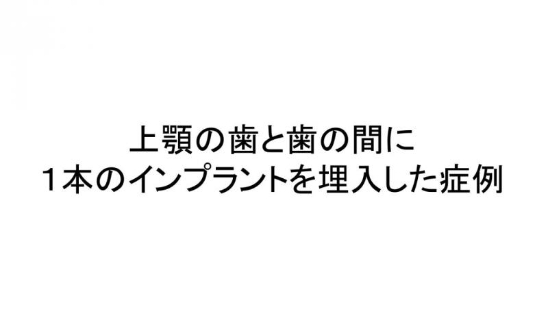 奥歯（上顎１歯）にインプラントを行った症例です。