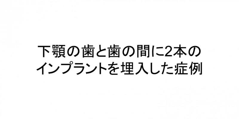 歯（下顎中間歯）にインプラントを行った症例です