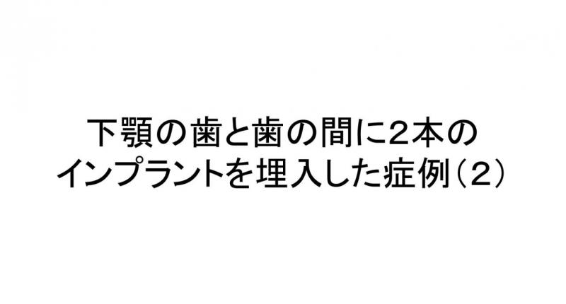 奥歯（下顎中間歯）にインプラントを行った症例です