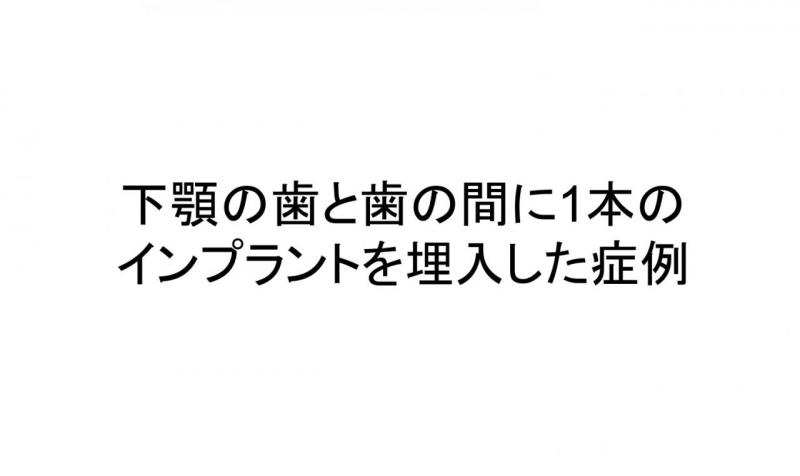 下顎単一歯欠損症例