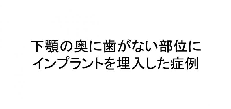 奥歯（下顎遊離端）にインプラントを行った症例です（２）