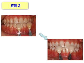 症例2です。