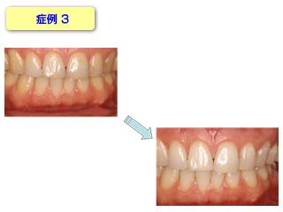 症例3です。