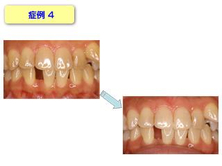 症例4です。