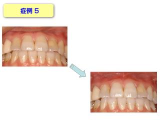 症例5です。