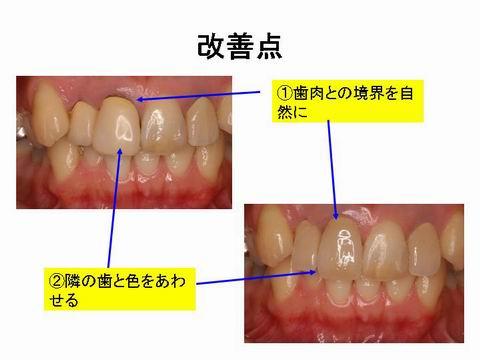 治療前後の写真を並べたものです。