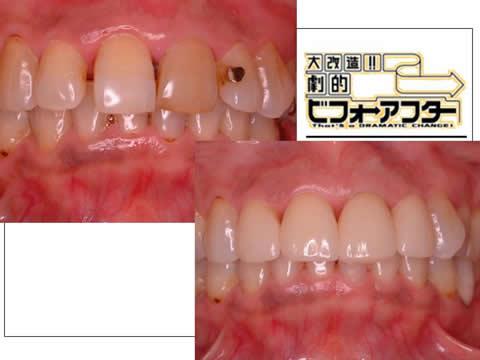 さしずめ大改造！！劇的ビフォー・アフターです。これも匠の技です。